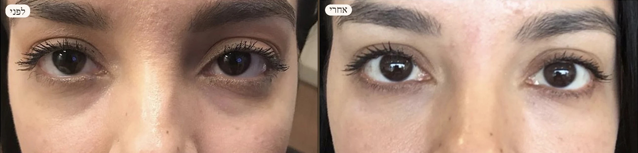 לפני ואחרי — דנה, 29