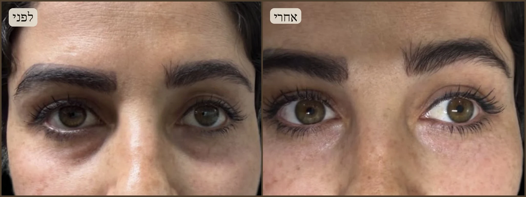 לפני ואחרי — סיגל, 38
